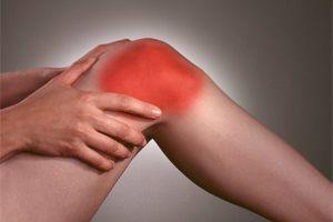 Artrose de joelho