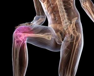 Inflamação da articulação do joelho com artrose