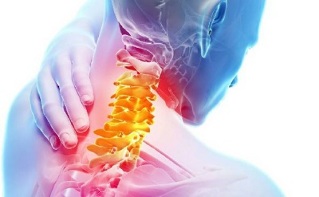 sintomas de osteocondrose da coluna cervical
