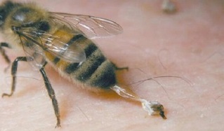 tratamento de artrose de quadril por abelhas