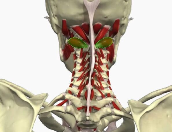 Síndrome da artéria vertebral